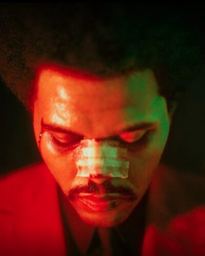 Grammys: The Weeknd mit Nasenpflaster